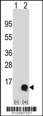Western blot analysis of his-tag CLPS (arrow) using his tag antibody. 293 cell lysates (2 ug/lane) either nontransfected (Lane 1) or transiently transfected with the CLPS gene