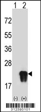 Western blot analysis of his-tag CLDN3 (arrow) using his tag antibody. 293 cell lysates (2 ug/lane) either nontransfected (Lane 1) or transiently transfected with the CLDN3 gene