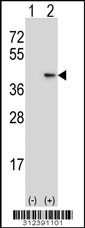 Western blot analysis of his-tag CISH (arrow) using his tag antibody. 293 cell lysates (2 ug/lane) either nontransfected (Lane 1) or transiently transfected with the CISH gene
