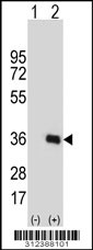 Western blot analysis of his-tag CHRNA7 (arrow) using his tag antibody. 293 cell lysates (2 ug/lane) either nontransfected (Lane 1) or transiently transfected with the CHRNA7 gene