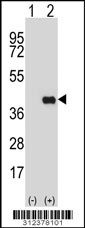 Western blot analysis of his-tag CHAD (arrow) using his tag antibody. 293 cell lysates (2 ug/lane) either nontransfected (Lane 1) or transiently transfected with the CHAD gene