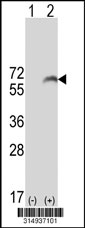 Western blot analysis of his-tag SPINT1 (arrow) using his tag antibody. 293T cell lysates (2 ug/lane) either nontransfected (Lane 1) or transiently transfected with the SPINT1 gene‘