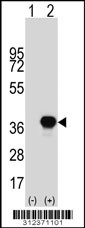Western blot analysis of his-tag CEBPE (arrow) using his tag antibody. 293 cell lysates (2 ug/lane) either nontransfected (Lane 1) or transiently transfected with the CEBPE gene