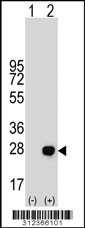 Western blot analysis of his-tag CDO1 (arrow) using his tag antibody. 293 cell lysates (2 ug/lane) either nontransfected (Lane 1) or transiently transfected with the CDO1 gene