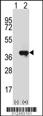 Western blot analysis of his-tag CDC34 (arrow) using his tag antibody. 293 cell lysates (2 ug/lane) either nontransfected (Lane 1) or transiently transfected with the CDC34 gene