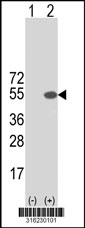 Western blot analysis of his-tag PDCD4 (arrow) using his tag antibody. 293T cell lysates (2 ug/lane) either nontransfected (Lane 1) or transiently transfected with the PDCD4 gene‘