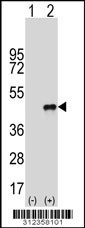 Western blot analysis of his-tag CD72 (arrow) using his tag antibody. 293 cell lysates (2 ug/lane) either nontransfected (Lane 1) or transiently transfected with the CD72 gene