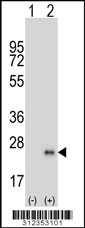 Western blot analysis of his-tag CD3E (arrow) using his tag antibody. 293 cell lysates (2 ug/lane) either nontransfected (Lane 1) or transiently transfected with the CD3E gene
