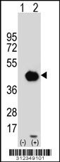 Western blot analysis of his-tag CD1D (arrow) using his tag antibody. 293 cell lysates (2 ug/lane) either nontransfected (Lane 1) or transiently transfected with the CD1D gene