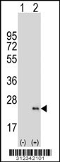Western blot analysis of his-tag CA6 (arrow) using his tag antibody. 293 cell lysates (2 ug/lane) either nontransfected (Lane 1) or transiently transfected with the CA6 gene