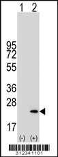 Western blot analysis of his-tag C8G (arrow) using his tag antibody. 293 cell lysates (2 ug/lane) either nontransfected (Lane 1) or transiently transfected with the C8G gene