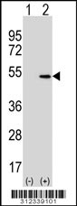 Western blot analysis of his-tag BMP7 (arrow) using his tag antibody. 293 cell lysates (2 ug/lane) either nontransfected (Lane 1) or transiently transfected with the BMP7 gene