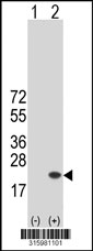 Western blot analysis of his-tag HIST1H3A (arrow) using his tag antibody. 293T cell lysates (2 ug/lane) either nontransfected (Lane 1) or transiently transfected with the HIST1H3A gene‘