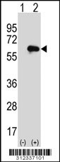 Western blot analysis of his-tag BIN1 (arrow) using his tag antibody. 293 cell lysates (2 ug/lane) either nontransfected (Lane 1) or transiently transfected with the BIN1 gene