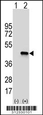 Western blot analysis of his-tag ATP1B1 (arrow) using his tag antibody. 293 cell lysates (2 ug/lane) either nontransfected (Lane 1) or transiently transfected with the ATP1B1 gene