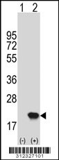 Western blot analysis of his-tag ARF1 (arrow) using his tag antibody. 293 cell lysates (2 ug/lane) either nontransfected (Lane 1) or transiently transfected with the ARF1 gene