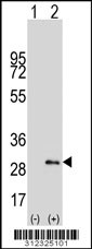 Western blot analysis of his-tag AQP5 (arrow) using his tag antibody. 293 cell lysates (2 ug/lane) either nontransfected (Lane 1) or transiently transfected with the AQP5 gene