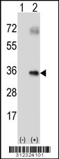 Western blot analysis of his-tag AQP4 (arrow) using his tag antibody. 293 cell lysates (2 ug/lane) either nontransfected (Lane 1) or transiently transfected with the AQP4 gene
