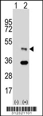 Western blot analysis of his-tag ALDH3B2 (arrow) using his tag antibody. 293 cell lysates (2 ug/lane) either nontransfected (Lane 1) or transiently transfected with the ALDH3B2 gene
