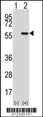 Western blot analysis of his-tag AL1A1 (arrow) using his tag antibody. 293 cell lysates (2 ug/lane) either nontransfected (Lane 1) or transiently transfected with the AL1A1 gene