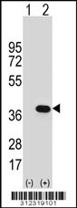 Western blot analysis of his-tag AKR1C4 (arrow) using his tag antibody. 293 cell lysates (2 ug/lane) either nontransfected (Lane 1) or transiently transfected with the AKR1C4 gene
