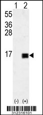 Western blot analysis of his-tag ACYP2 (arrow) using his tag antibody. 293 cell lysates (2 ug/lane) either nontransfected (Lane 1) or transiently transfected with the ACYP2 gene