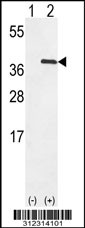 Western blot analysis of his-tag ACP5 (arrow) using his tag antibody. 293 cell lysates (2 ug/lane) either nontransfected (Lane 1) or transiently transfected with the ACP5 gene