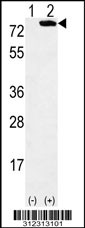 Western blot analysis of his-tag ACOX1 (arrow) using his tag antibody. 293 cell lysates (2 ug/lane) either nontransfected (Lane 1) or transiently transfected with the ACOX1 gene