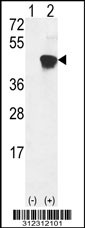 Western blot analysis of his-tag ACAA1 (arrow) using his tag antibody. 293 cell lysates (2 ug/lane) either nontransfected (Lane 1) or transiently transfected with the ACAA1 gene