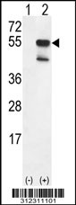 Western blot analysis of his-tag SERPINA6 (arrow) using his tag antibody. 293 cell lysates (2 ug/lane) either nontransfected (Lane 1) or transiently transfected with the SERPINA6 gene