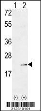 Western blot analysis of his-tag RHOG (arrow) using his tag antibody. 293 cell lysates (2 ug/lane) either nontransfected (Lane 1) or transiently transfected with the RHOG gene