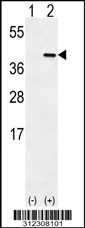 Western blot analysis of his-tag CD1B (arrow) using his tag antibody. 293 cell lysates (2 ug/lane) either nontransfected (Lane 1) or transiently transfected with the CD1B gene