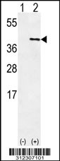 Western blot analysis of his-tag CCBL1 (arrow) using his tag antibody. 293 cell lysates (2 ug/lane) either nontransfected (Lane 1) or transiently transfected with the CCBL1 gene
