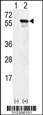 Western blot analysis of his-tag CASQ1 (arrow) using his tag antibody. 293 cell lysates (2 ug/lane) either nontransfected (Lane 1) or transiently transfected with the CASQ1 gene