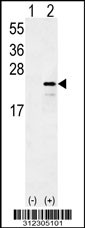 Western blot analysis of his-tag CAMP (arrow) using his tag antibody. 293 cell lysates (2 ug/lane) either nontransfected (Lane 1) or transiently transfected with the CAMP gene