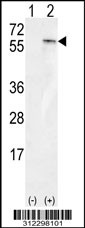 Western blot analysis of his-tag BMP3 (arrow) using his tag antibody. 293 cell lysates (2 ug/lane) either nontransfected (Lane 1) or transiently transfected with the BMP3 gene