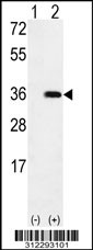 Western blot analysis of his-tag ATP6V1E1 (arrow) using his tag antibody. 293 cell lysates (2 ug/lane) either nontransfected (Lane 1) or transiently transfected with the ATP6V1E1 gene