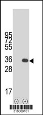 Western blot analysis of his-tag MTG1 (arrow) using his tag antibody. 293T cell lysates (2 ug/lane) either nontransfected (Lane 1) or transiently transfected with the MTG1 gene‘