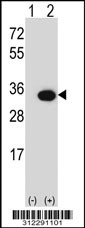Western blot analysis of his-tag ATP1A4 (arrow) using his tag antibody. 293 cell lysates (2 ug/lane) either nontransfected (Lane 1) or transiently transfected with the ATP1A4 gene