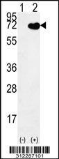 Western blot analysis of his-tag ARSF (arrow) using his tag antibody. 293 cell lysates (2 ug/lane) either nontransfected (Lane 1) or transiently transfected with the ARSF gene