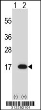 Western blot analysis of his-tag ANG (arrow) using his tag antibody. 293 cell lysates (2 ug/lane) either nontransfected (Lane 1) or transiently transfected with the ANG gene