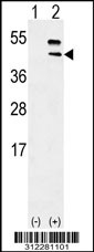 Western blot analysis of his-tag AMBP (arrow) using his tag antibody. 293 cell lysates (2 ug/lane) either nontransfected (Lane 1) or transiently transfected with the AMBP gene