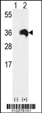 Western blot analysis of his-tag AES (arrow) using his tag antibody. 293 cell lysates (2 ug/lane) either nontransfected (Lane 1) or transiently transfected with the AES gene
