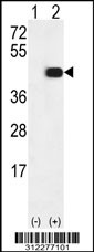 Western blot analysis of his-tag ADH7 (arrow) using his tag antibody. 293 cell lysates (2 ug/lane) either nontransfected (Lane 1) or transiently transfected with the ADH7 gene