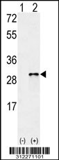 Western blot analysis of his-tag RHOC (arrow) using his tag antibody. 293 cell lysates (2 ug/lane) either nontransfected (Lane 1) or transiently transfected with the RHOC gene