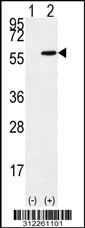 Western blot analysis of his-tag ATP6V1B1 (arrow) using his tag antibody. 293 cell lysates (2 ug/lane) either nontransfected (Lane 1) or transiently transfected with the ATP6V1B1 gene