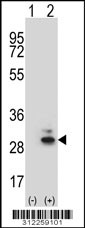 Western blot analysis of his-tag ASPH (arrow) using his tag antibody. 293 cell lysates (2 ug/lane) either nontransfected (Lane 1) or transiently transfected with the ASPH gene