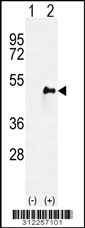 Western blot analysis of his-tag ARNT (arrow) using his tag antibody. 293 cell lysates (2 ug/lane) either nontransfected (Lane 1) or transiently transfected with the ARNT gene