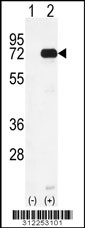 Western blot analysis of his-tag APLP2 (arrow) using his tag antibody. 293 cell lysates (2 ug/lane) either nontransfected (Lane 1) or transiently transfected with the APLP2 gene