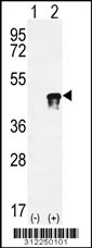 Western blot analysis of his-tag ADA (arrow) using his tag antibody. 293 cell lysates (2 ug/lane) either nontransfected (Lane 1) or transiently transfected with the ADA gene